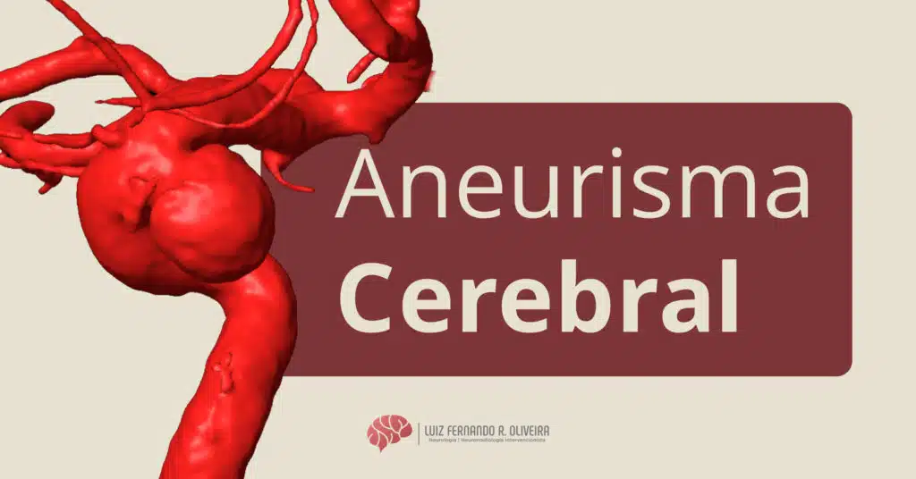 Título de artigo sobre aneurismas cerebrais com ilustração de um aneurisma da carótida interna