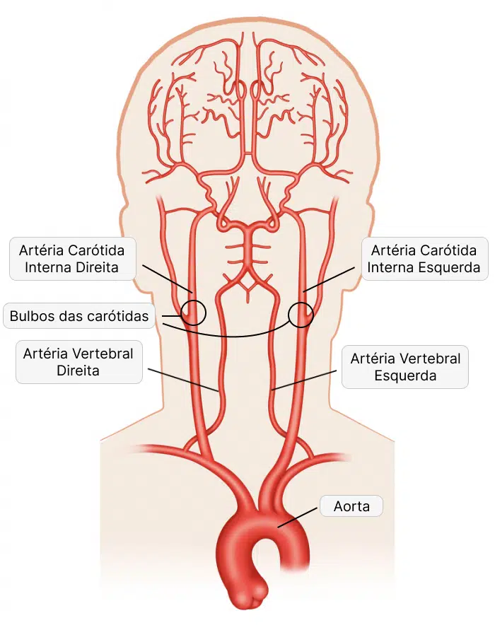 figura ilustrando a localização da carótida interna e deos demais vasos do pescoço