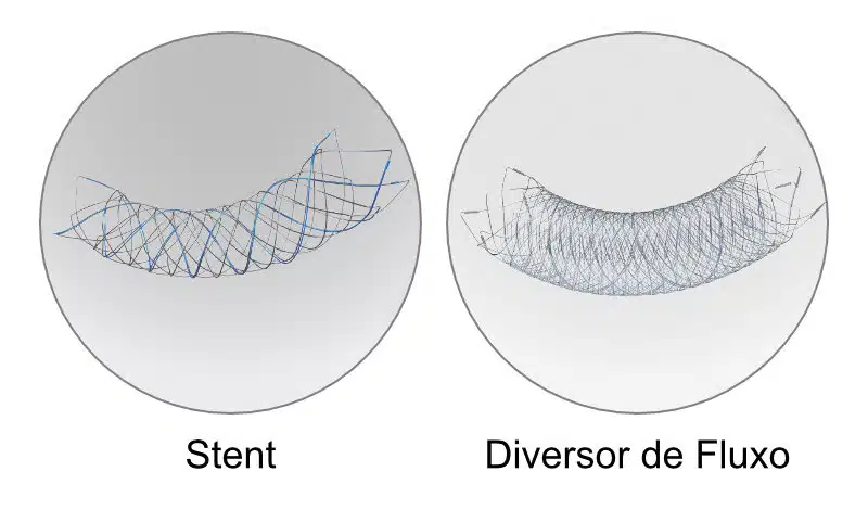 Comparação entre a malha dos stents comuns e do diversor de fluxo.