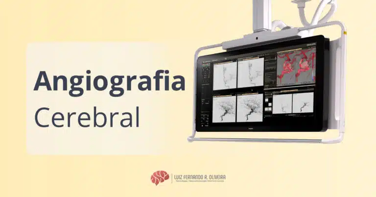 Título de artigo sobre angiografia cerebral com ilustração de um exames de angiografia