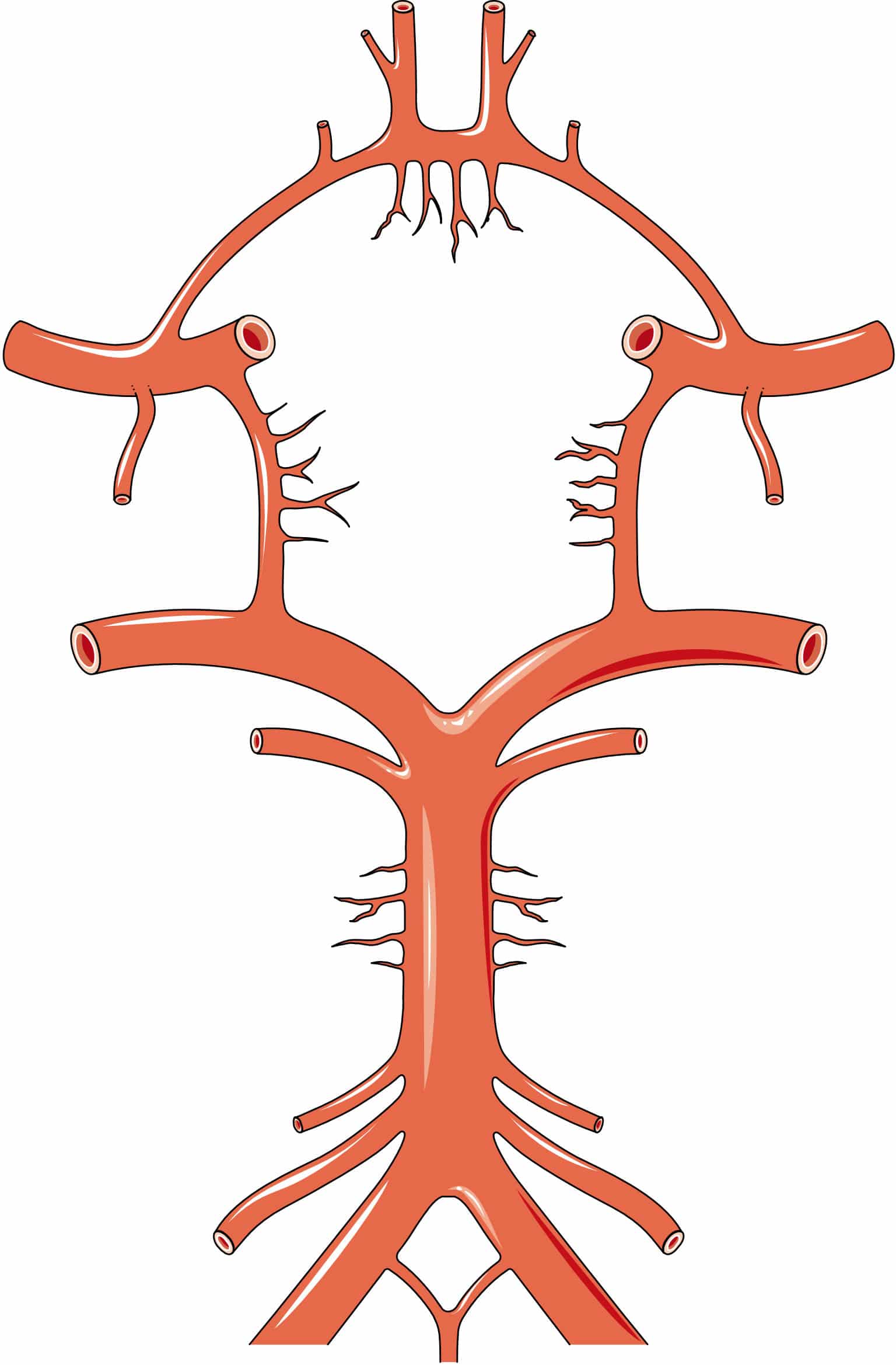 O polígono de Willis tem ramificações e bifurcações com aneurismas