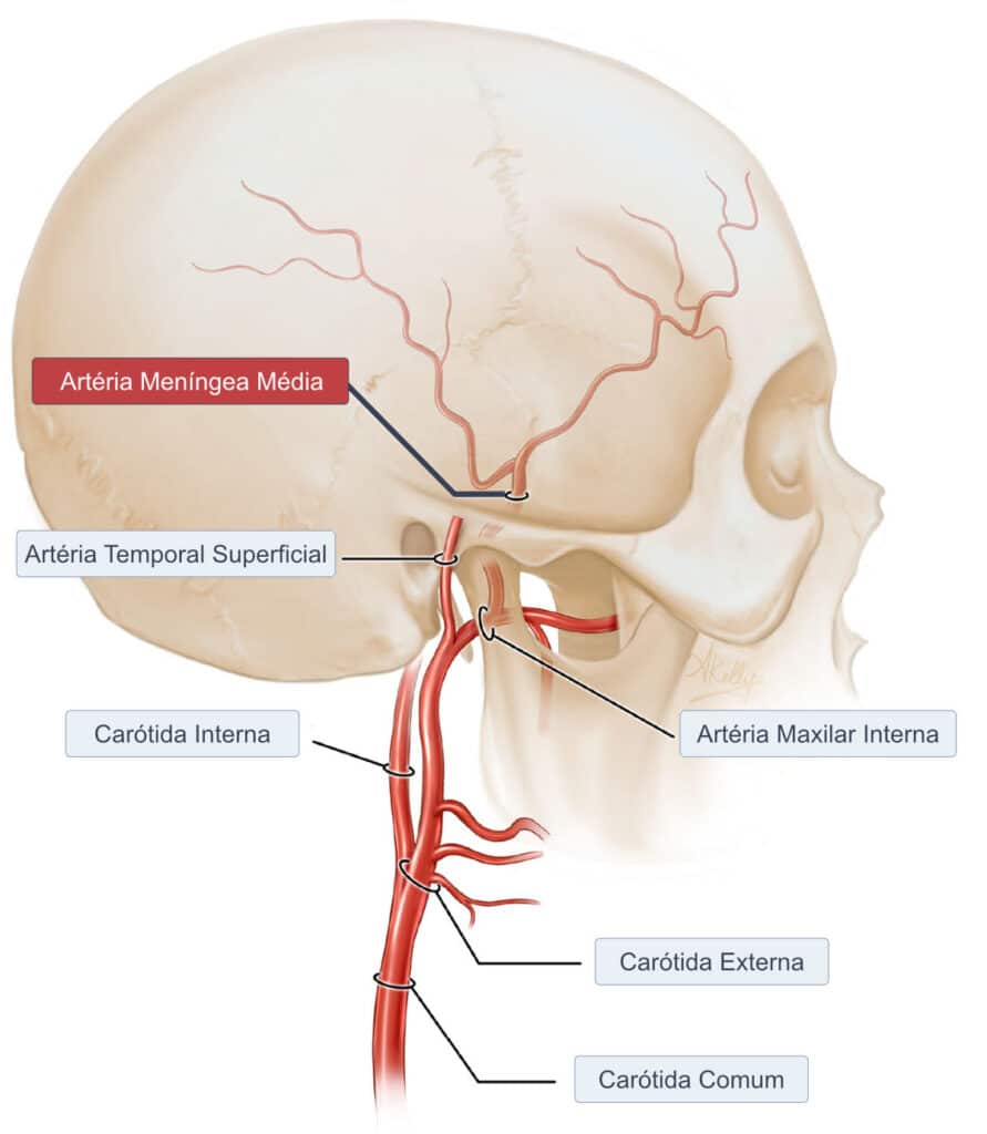 Artéria meníngea média leva sangue para a meninge dura mater